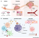 Abbildung 1 aus dem Review-Artikel: Stadien der Tumorentwicklung (A) und allergische Reaktion vom Typ 1 (B).